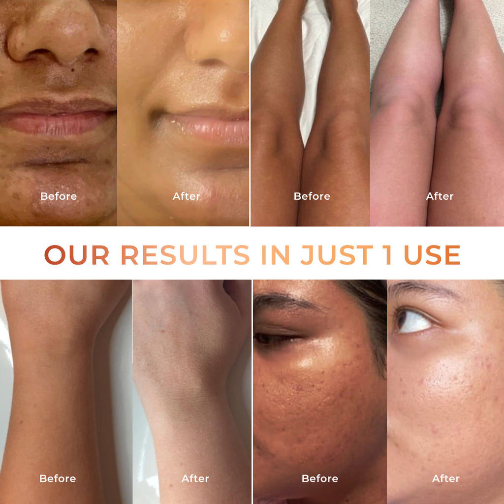 Niconi Tan Vanish Gluta-Kojic Skin Polish 180g