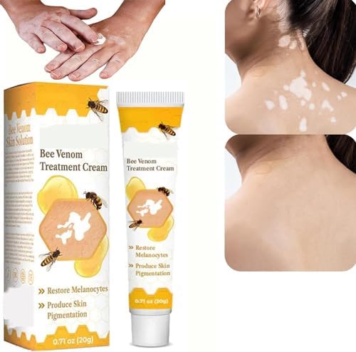 Bee Venom Vitiligo Cream, Beevenom Vitiligo Treatment Cream for All Skin Types