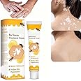 Bee Venom Vitiligo Cream, Beevenom Vitiligo Treatment Cream for All Skin Types