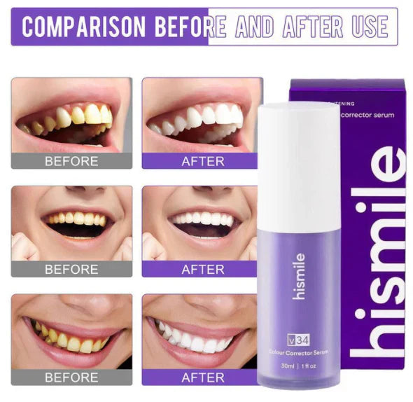 Hismile v34 Color Corrector Serum - Instant Teeth Whitening